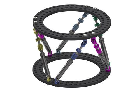 Computer assisted circular external fixator system